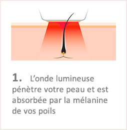 Lumiere Pulsee Cocoon Beaute Bien Etre Institut De Beaute Soins Du Corps Illustation Fonctionnement Etape 1