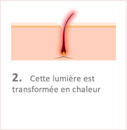 Lumiere Pulsee Cocoon Beaute Bien Etre Institut De Beaute Soins Du Corps Illustation Fonctionnement Etape 2